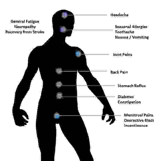 Carolina MD Acupuncture